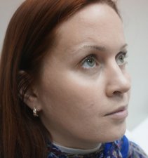После